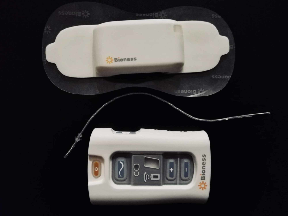 Peripheral Nerve Stimulators Medical Devices Pipeline Product Analysis Peripheral Nerve Stimulation | The Pain Relief Center