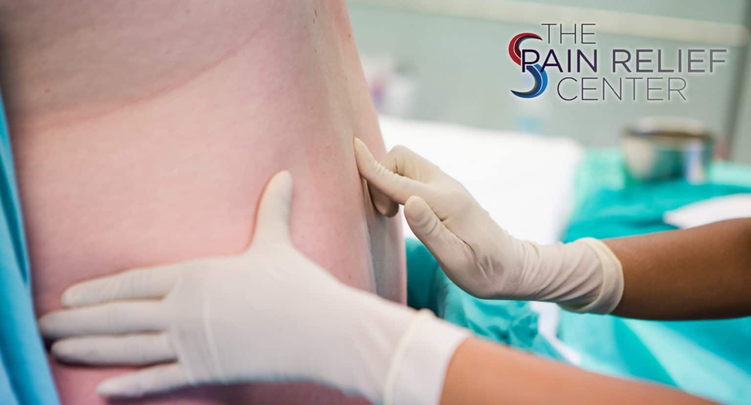 Caudal Epidural Steroid Injection The Pain Relief Center Frisco & Plano